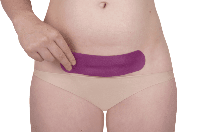 Scarban C-Section