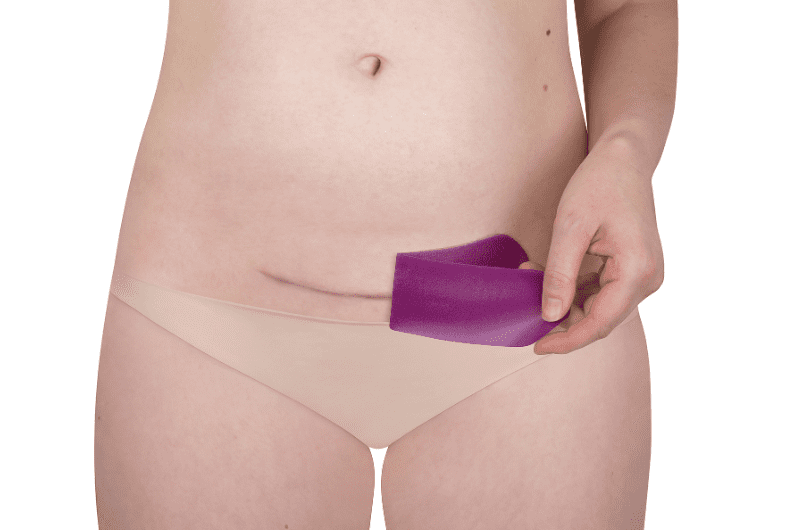 Scarban C-Section