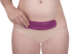 Scarban C-Section