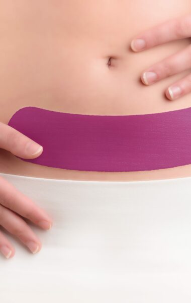 Scarban C-section op keizersnede litteken